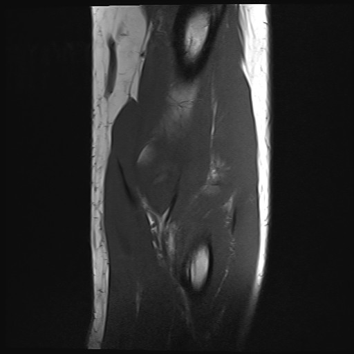 Click on the Serie image to view the images of Wieszt, Gnter